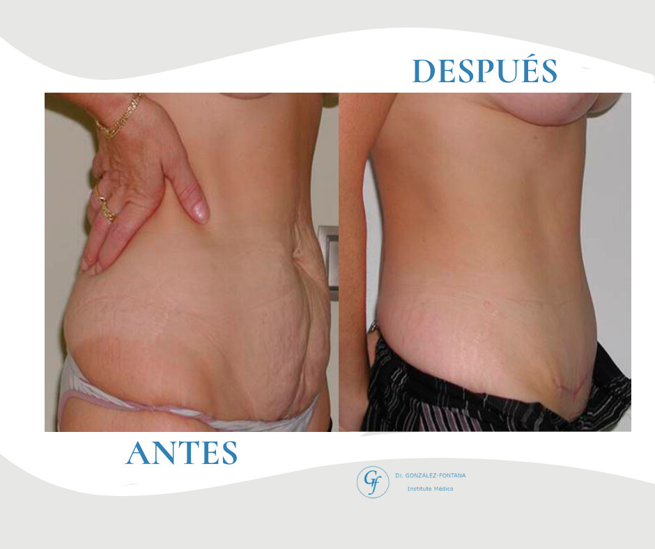 Clinic Results Gallery